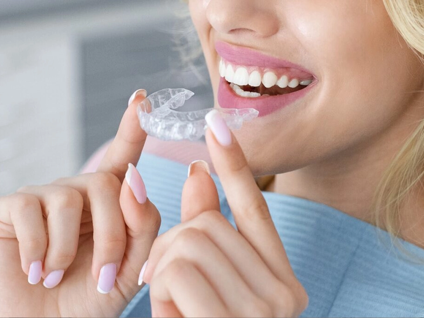 Patient wearing clear aligners