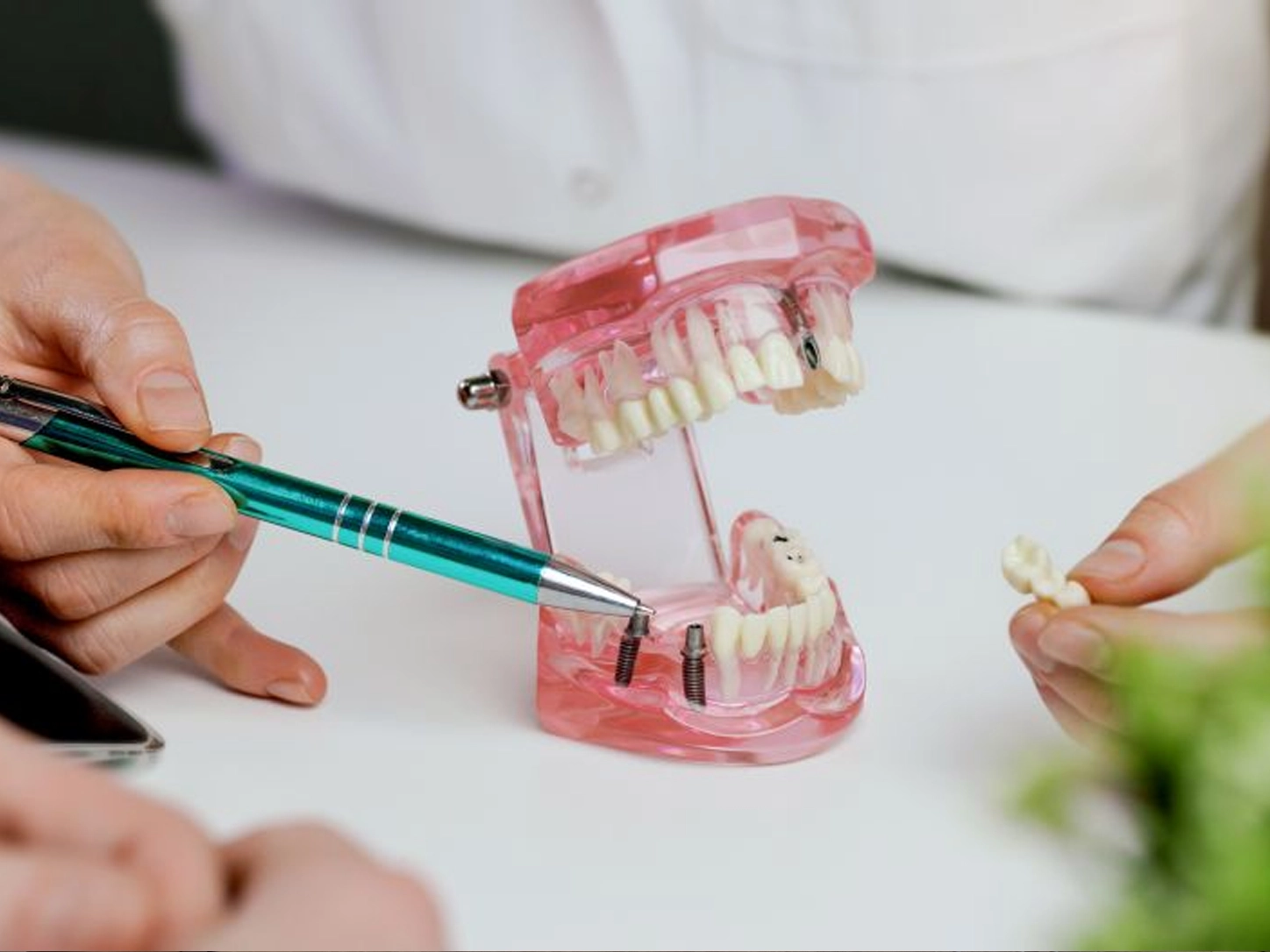Dentist consulting with patient about dental implants