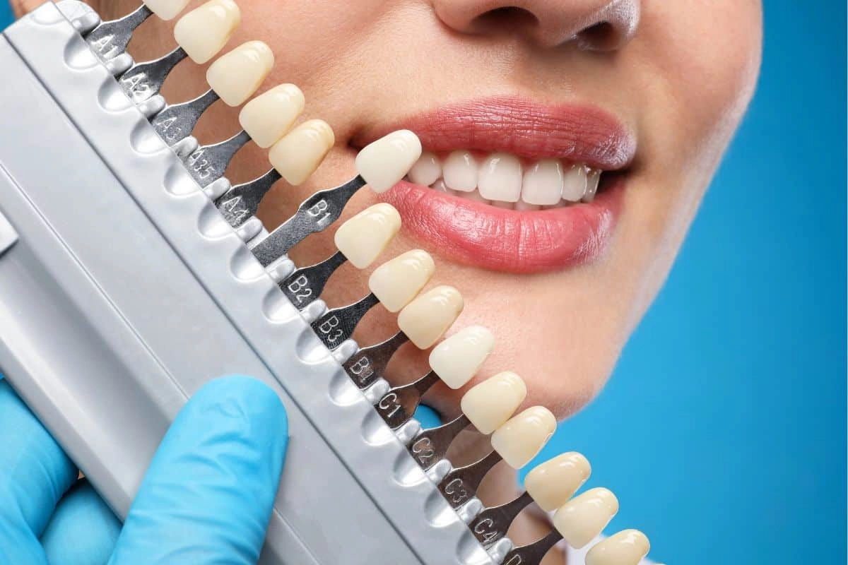 Cosmetic Dentistry at Gateway Dental