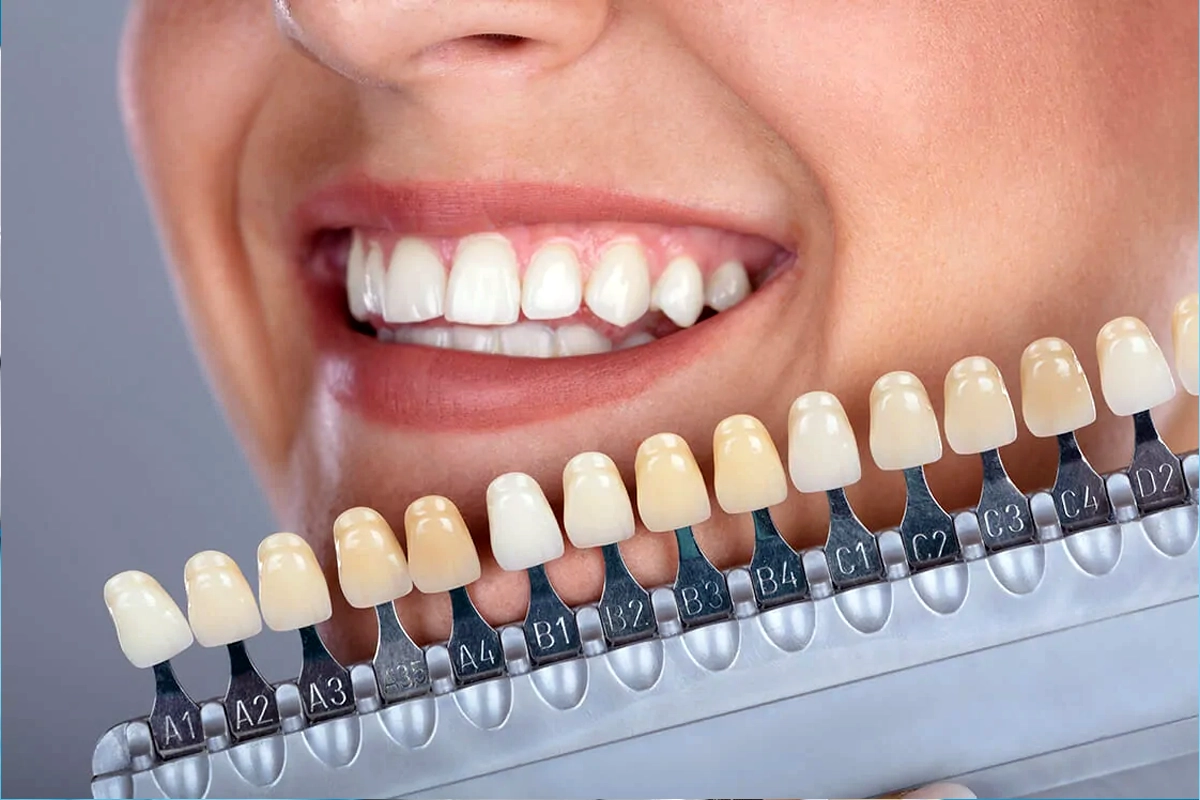 Cosmetic Dentistry at Gateway Dental