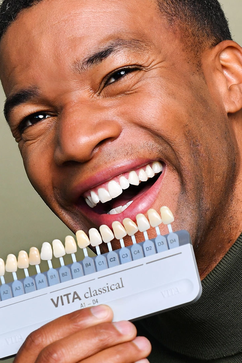 Dental Veneers at Gateway Dental