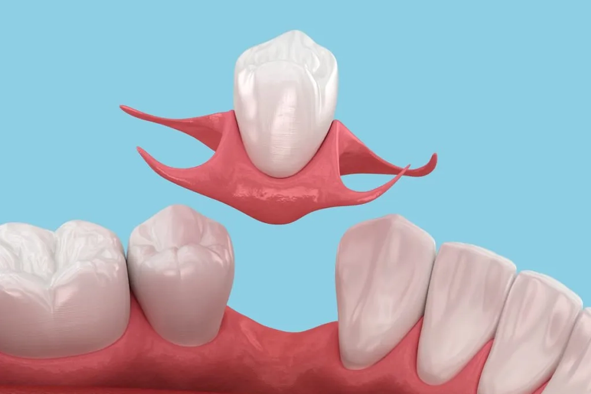 Dentures and Partials at Gateway Dental