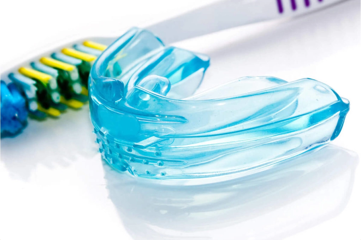 Mouth Guards at Gateway Dental