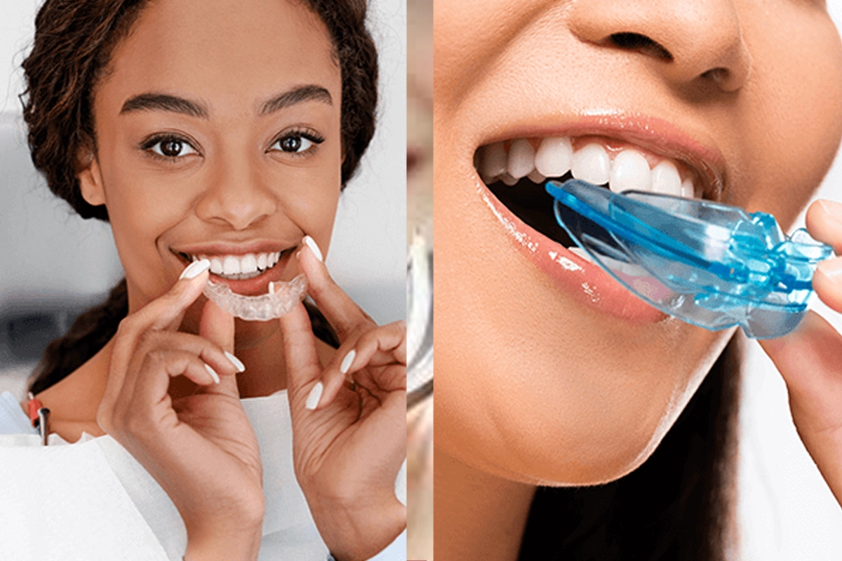Mouth Guards