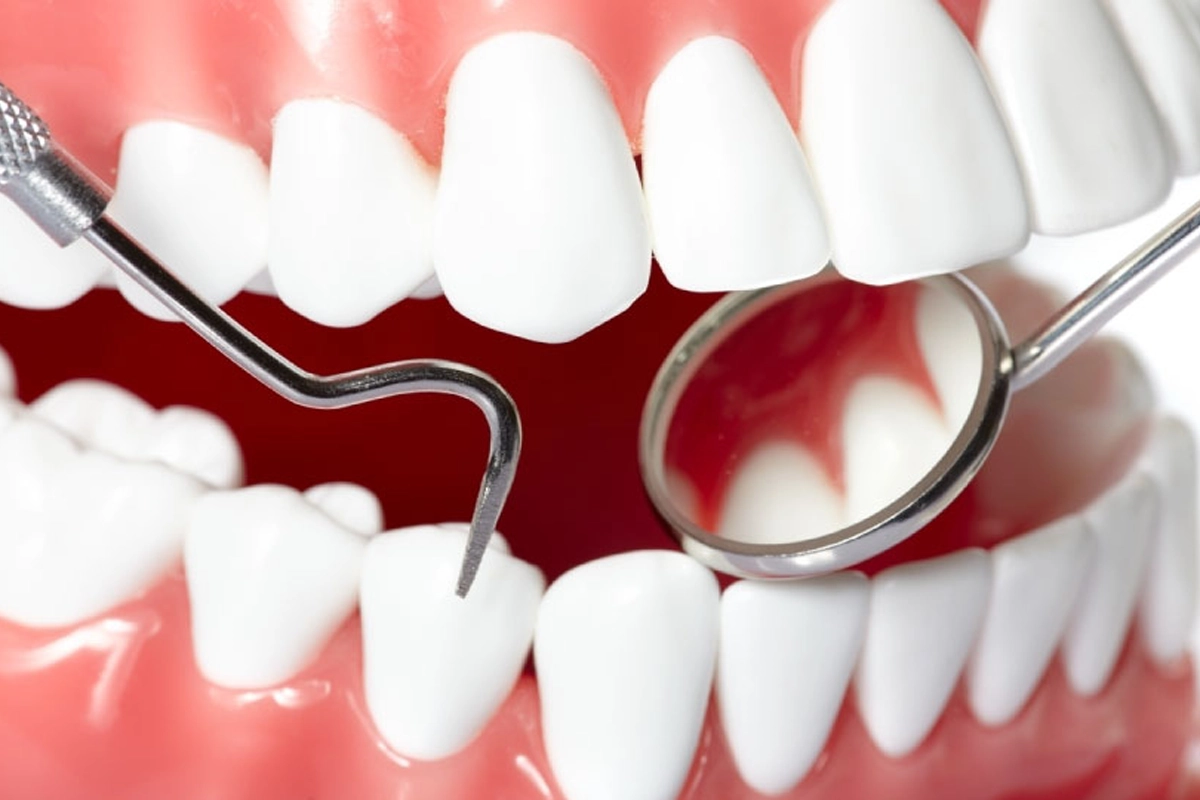 Oral Hygiene at Gateway Dental