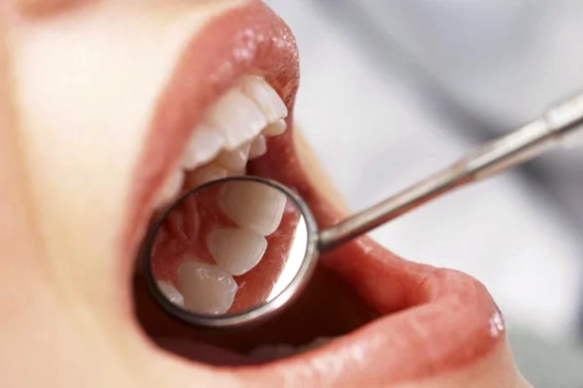 Oral Hygiene at Gateway Dental
