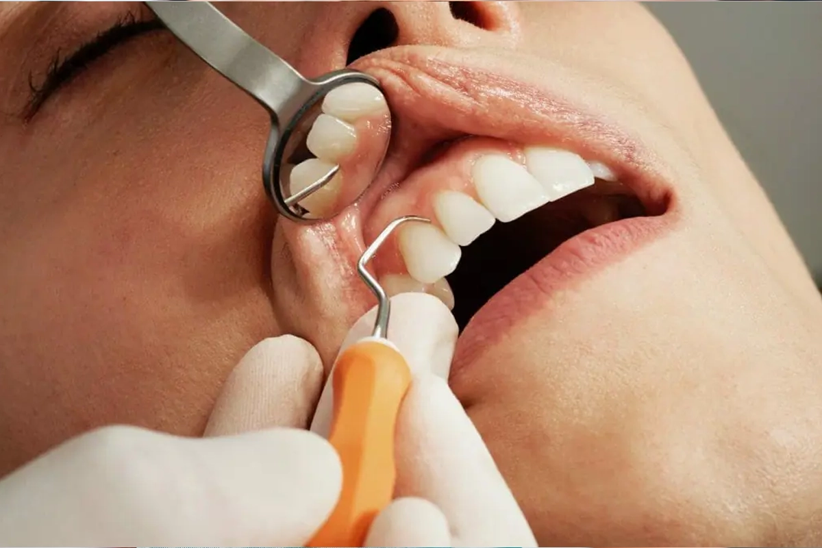Preventive Dentistry at Gateway Dental