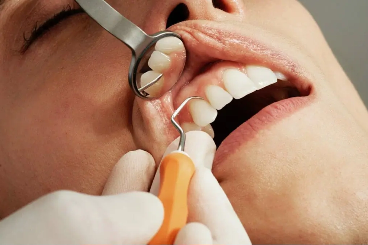 Preventive Dentistry