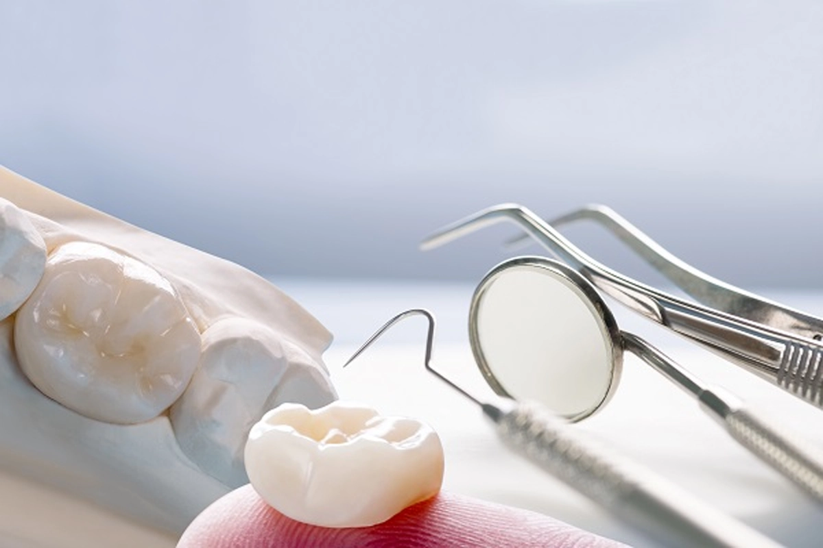 Restorative Dentistry at Gateway Dental