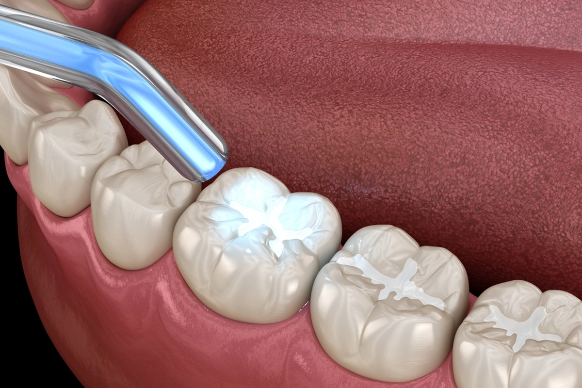 Restorative Dentistry