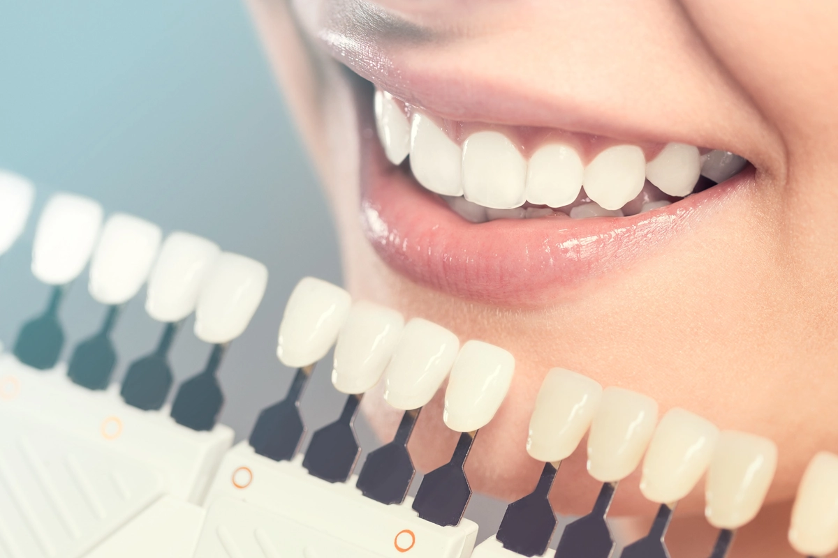 Cosmetic Dentistry