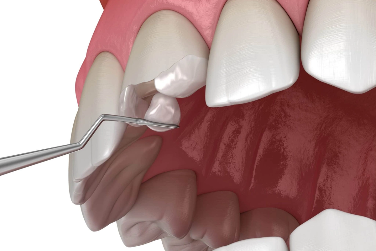 Restorative Dentistry