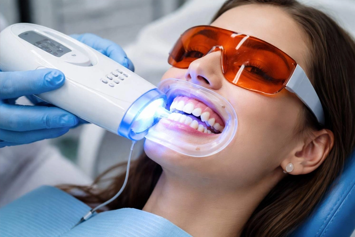 Teeth Whitening at Gateway Dental